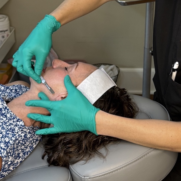 Dermaplaning a patient's face